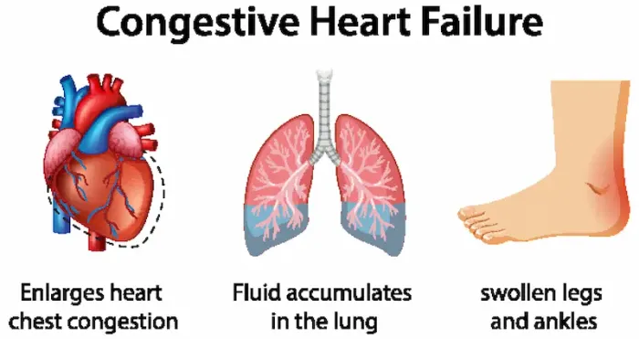 Signs Of Do You Know The Warning Signs And Signs And Of Congestive Heart Failure